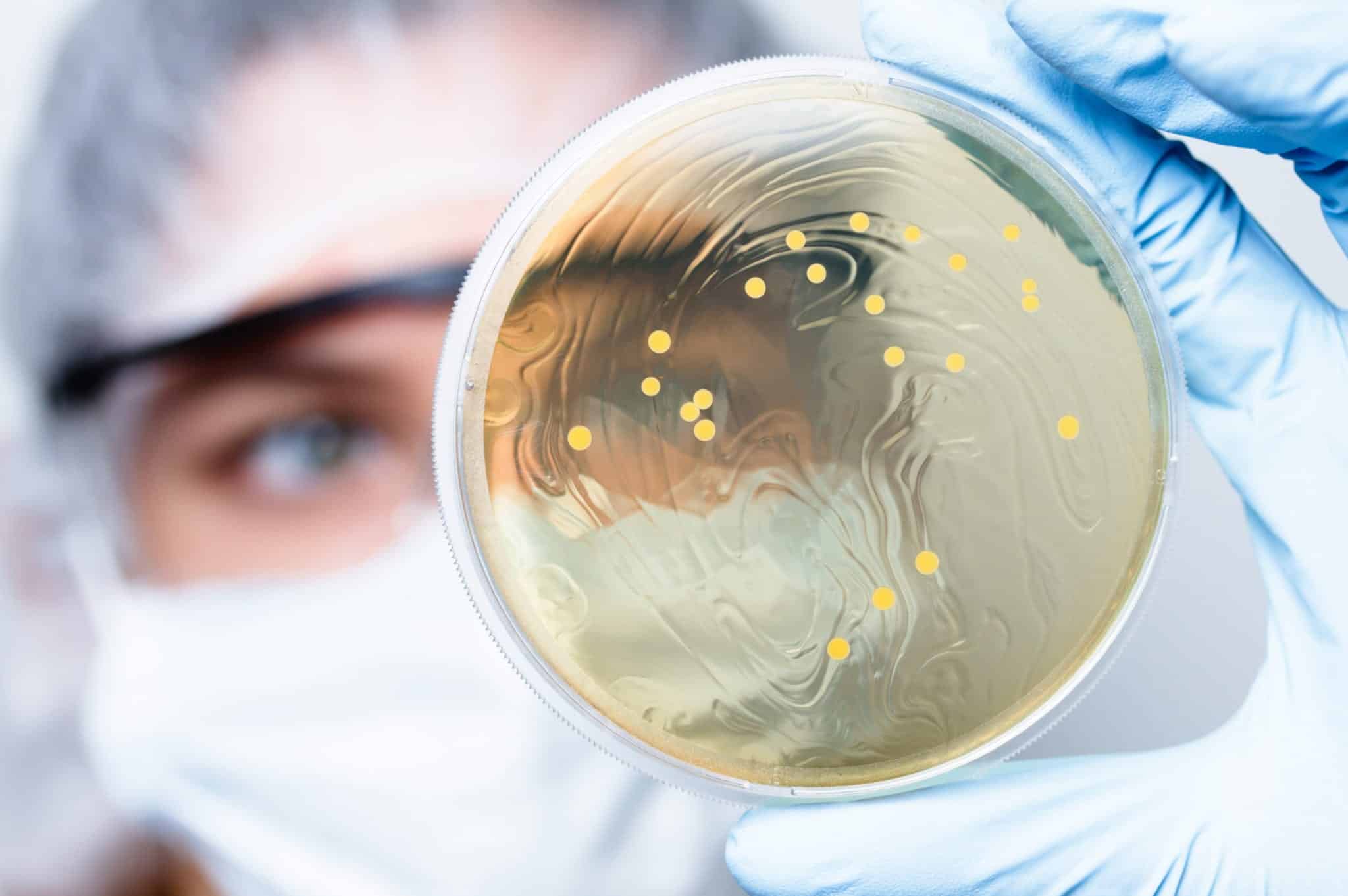 Antibiotic Resistant Bacteria